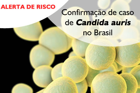 Alerta de Risco GVIMS / GGTES/Anvisa n 02/2020